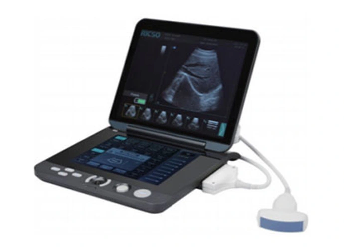 Mobile Ultrasound Diagnostic System